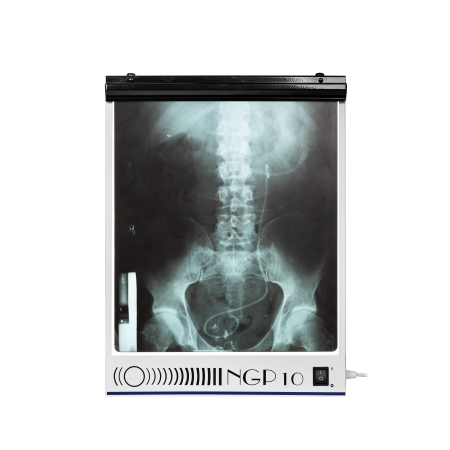 Negatoskop jednoklatkowy NGP 10 hf